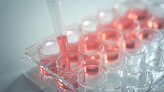 再生医療の核心に迫る！「幹細胞」と「幹細胞培養上清液」の違いとは？